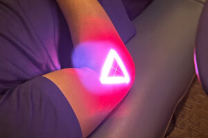 Class IV Laser Therapy — Stuart and Port St. Lucie FL Class IV laser therapy for pain relief and inflammation at Treasure Coast Spine and Sport