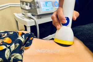 SoftWave Therapy — Treasure Coast Spine & Sport SoftWave therapy treatment for knee and shoulder pain in Stuart FL